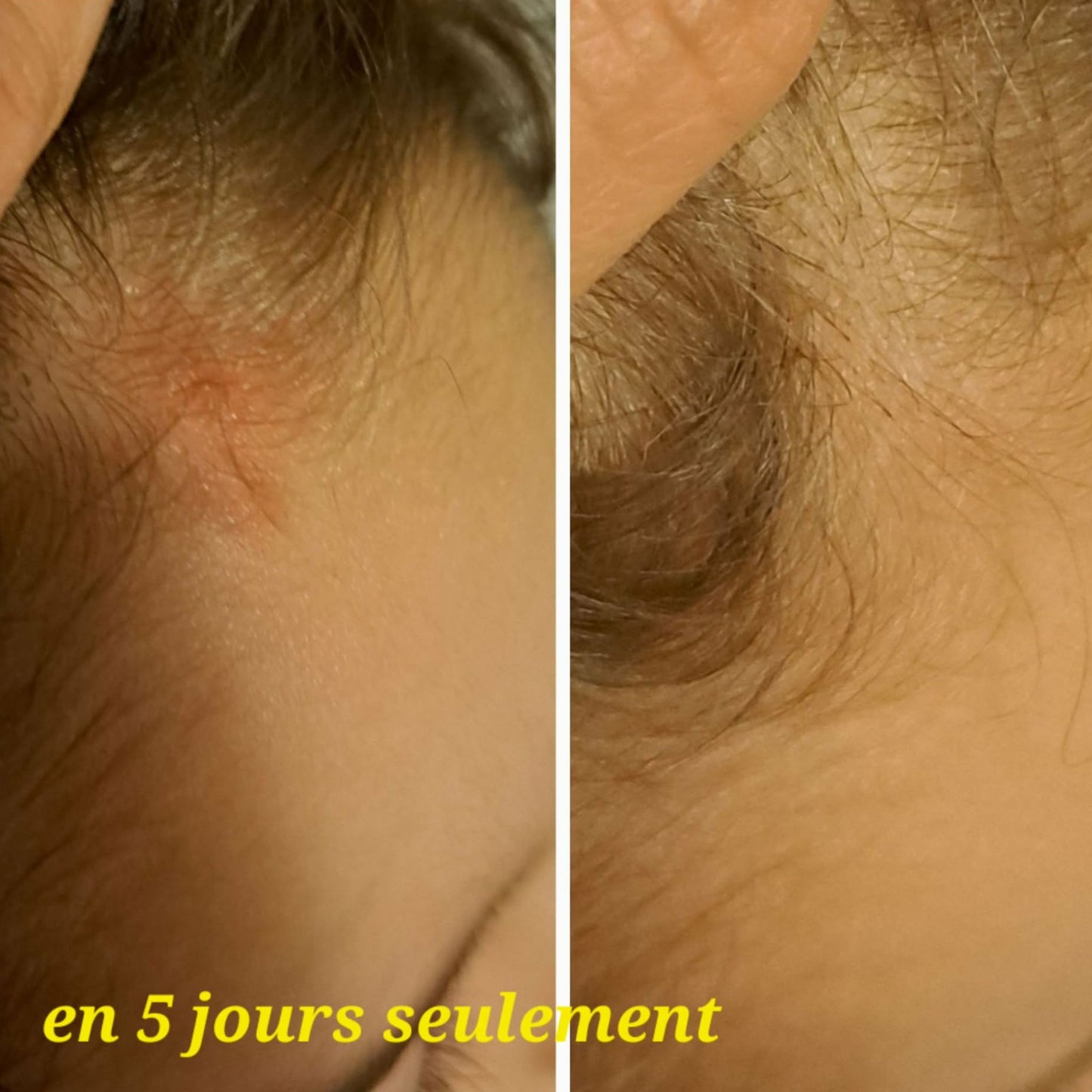Baume réparateur