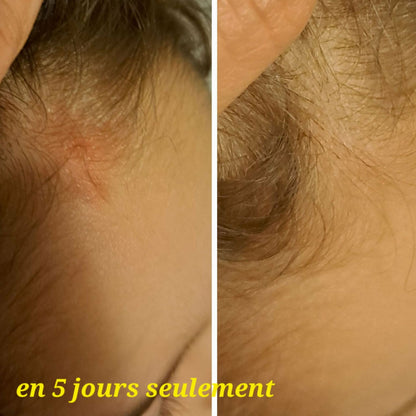 Baume réparateur